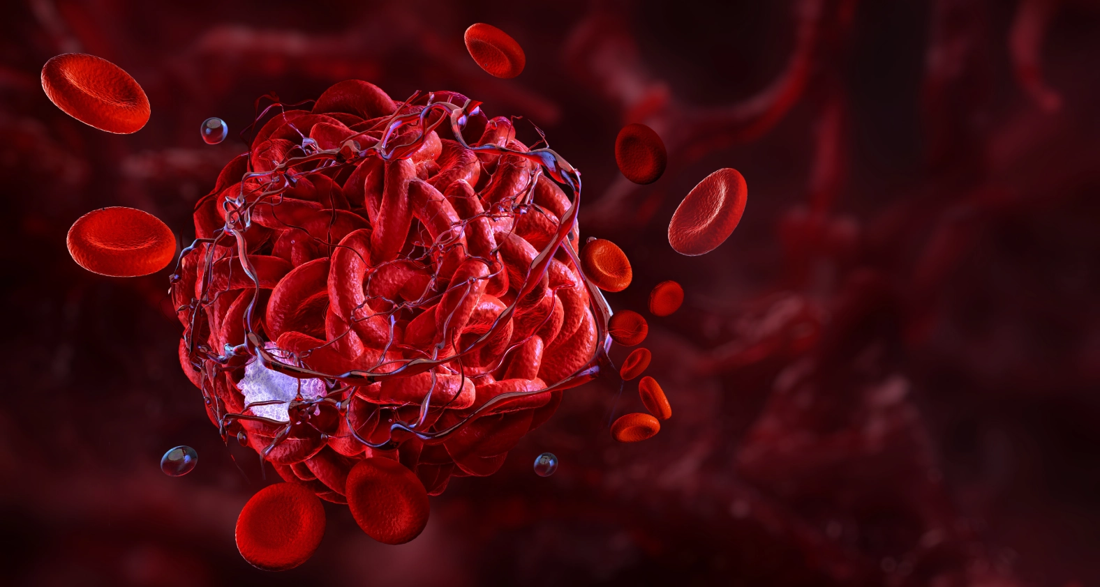 Curso de anticoagulación en escenarios cardiovasculares - LaCardio - LaCardio