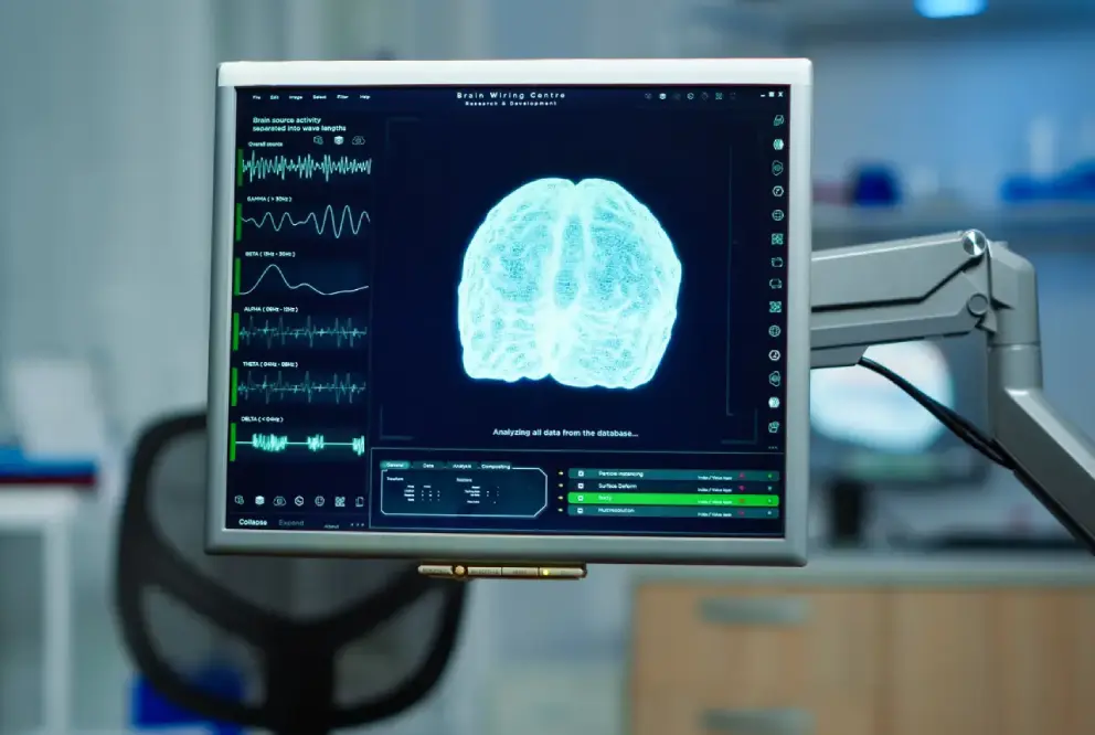 Neuroradiología intervencionista - LaCardio